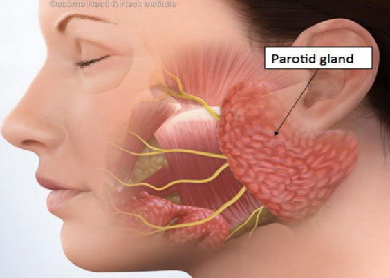 Sudden Hearing Loss in Hyderabad